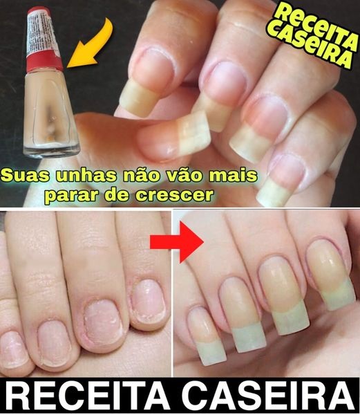 Esse é o Segredo Para Ter Unhas Grandes e Fortes Sem Gastar Muito